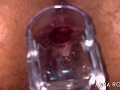 Anal vision speculum reveals hairy mature bbw's gaping asshole