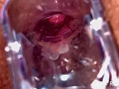 Anal vision speculum reveals hairy mature bbw's gaping asshole