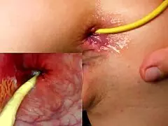 camera shoved deep in ass for intense anal creampie finish