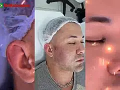 See My Stunning Facial Transformation Result?