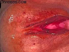 Amateur asian wife flaunts shaved pussy 356 days post virginity loss.